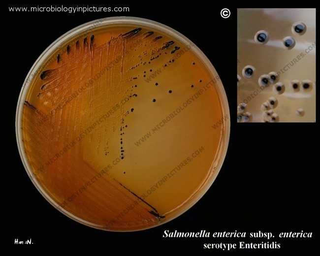 Salmonella Shigella Agar